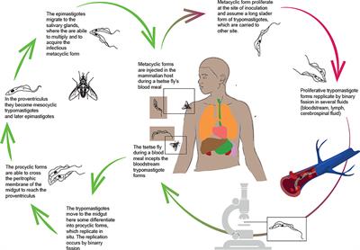 Human African Trypanosomiasis (sleeping sickness): Current knowledge and future challenges